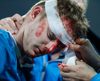 Illustration for article titled Zenit Player's Face Was A River Of Blood After Getting Kneed In Head